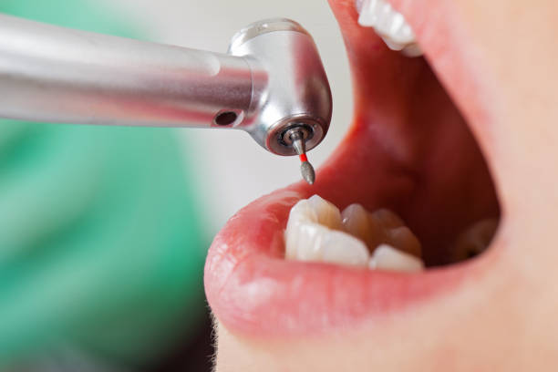 Best Broken Tooth Emergency  in Masontown, PA